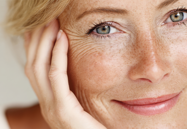 Dry skin during menopause
