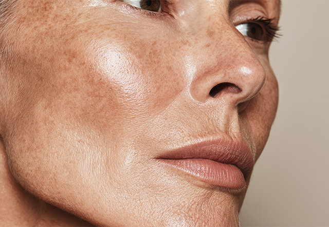 Skin problems on the face during menopause